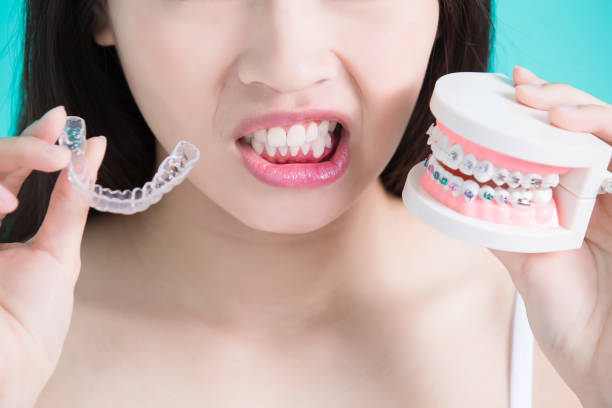 dental braces alternatives Thousand Oaks CA